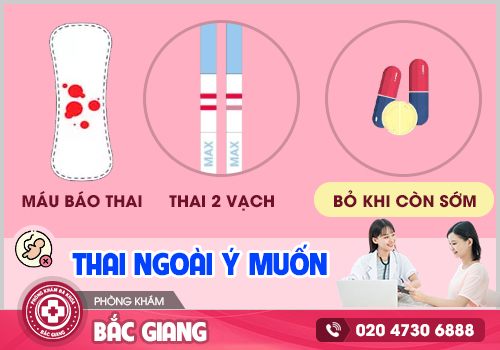 Dấu hiệu dính thai ngoài kế hoạch, tư vấn cách đình chỉ thai an toàn