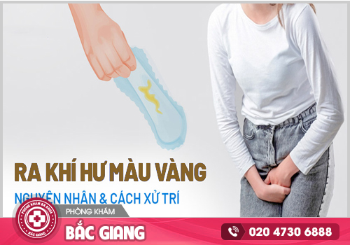 Âm đạo ra dịch màu vàng - Dấu hiệu bất thường cần thăm khám phụ khoa