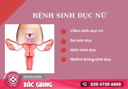 bệnh sinh dục nữ