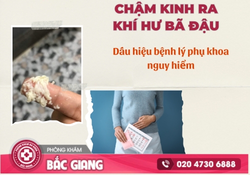 Chậm kinh ra khí hư bã đậu Nguyên nhân và cách điều trị hiệu quả