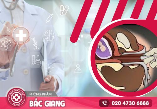 Chi phí phá thai 8 tuần hiện nay là bao nhiêu?