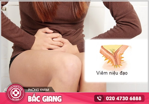 Chị em có nên tự chữa viêm niệu đạo tại nhà không?