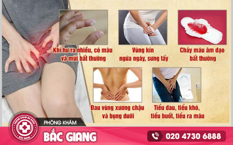 Nguyên nhân - Dấu hiệu viêm lộ tuyến cổ tử cung là gì?
