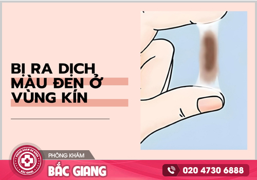 Ra dịch màu đen ở vùng kín - Cảnh báo các bệnh phụ khoa nguy hiểm cho nữ giới