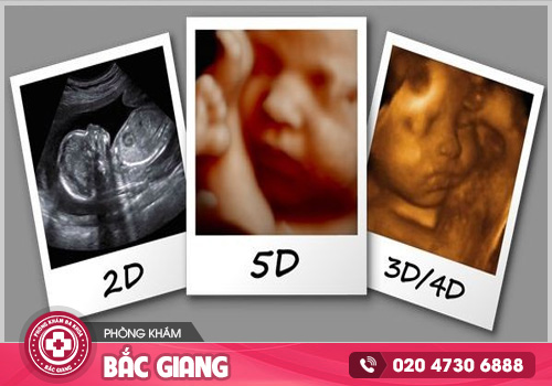 Giá siêu âm thai bao nhiêu tiền? Nên siêu âm ở đâu?