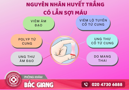 huyết trắng có lẫn sợi máu