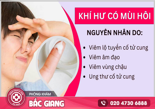 Khí hư có mùi là bệnh gì? Cách khắc phục hiệu quả