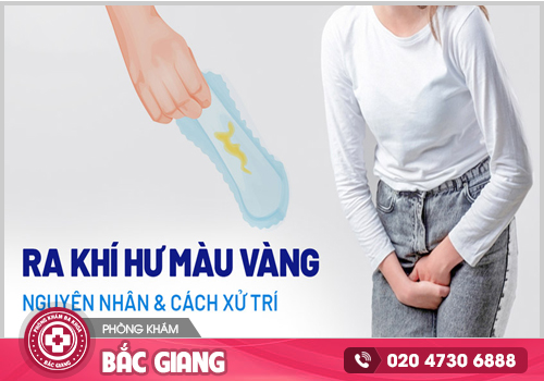 Hiện tượng khí hư màu vàng có đáng lo ngại không?
