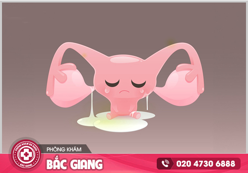 Âm đạo ra dịch màu trắng sữa: Những thông tin quan trọng