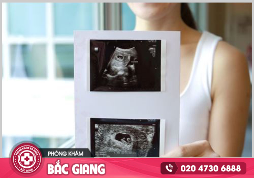 Phòng khám kiểm tra thai an toàn chính xác tại Bắc Giang