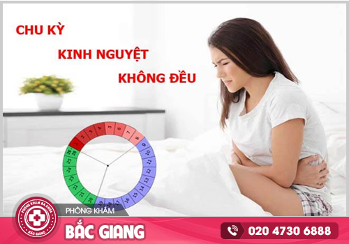 Kinh nguyệt không đều - Nỗi ám ảnh của phụ nữ và những điều cần biết
