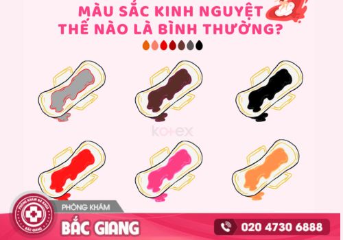 Màu sắc kinh nguyệt phản ánh sức khỏe sinh sản của nữ giới