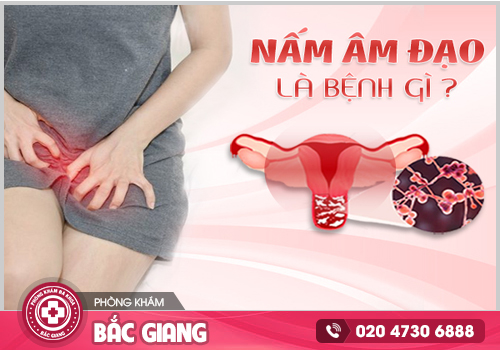 Anh có thể phân biệt ngựa chính hãng ở đây nha https://www.facebook.com/107955587289604/posts/pfbid0DDc9yQiGP41y98SbhSc9p9sW2kWspNyQpLHrmePtWkf5tdhWc89j1TjyXXNQQjFYl/?mibextid=Nif5oz