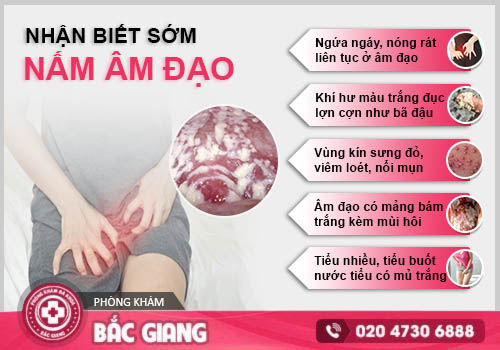 Anh có thể phân biệt ngựa chính hãng ở đây nha https://www.facebook.com/107955587289604/posts/pfbid0DDc9yQiGP41y98SbhSc9p9sW2kWspNyQpLHrmePtWkf5tdhWc89j1TjyXXNQQjFYl/?mibextid=Nif5oz