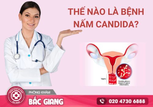 Nấm Candida - Thủ phạm gây viêm nhiễm vùng kín ở nữ giới
