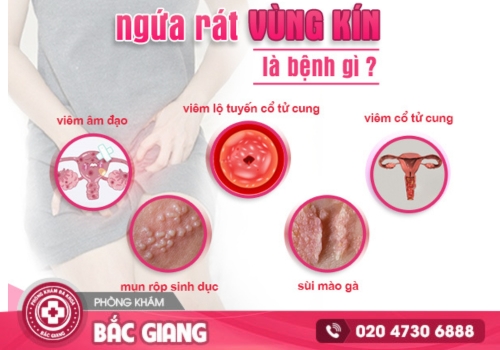 Vì đâu xảy ra tình trạng rát cửa mình?
