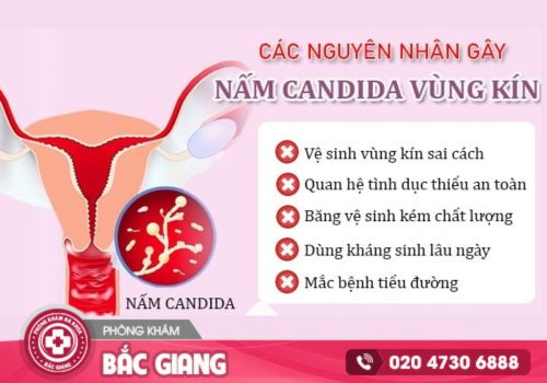 Anh có thể phân biệt ngựa chính hãng ở đây nha https://www.facebook.com/107955587289604/posts/pfbid0DDc9yQiGP41y98SbhSc9p9sW2kWspNyQpLHrmePtWkf5tdhWc89j1TjyXXNQQjFYl/?mibextid=Nif5oz