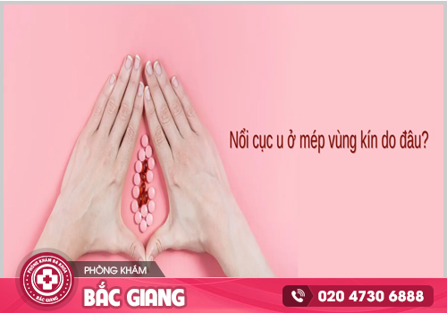 Nổi hạch ở bẹn vùng kín nữ không nên xem thường!