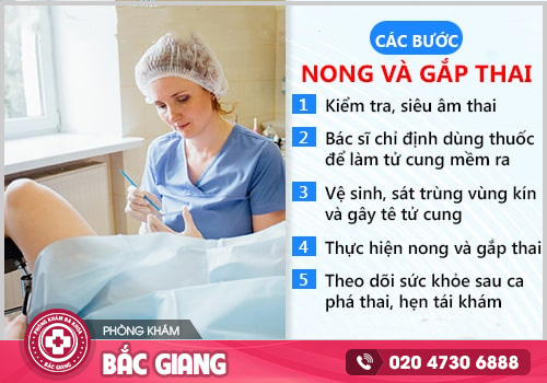 Phương pháp nong gắp thai và những điều chị em cần biết