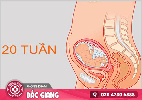 Tìm hiểu cách phá thai 20 tuần an toàn hiện nay