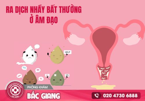 Ra dịch nhầy bất thường ở âm đạo có sao không?