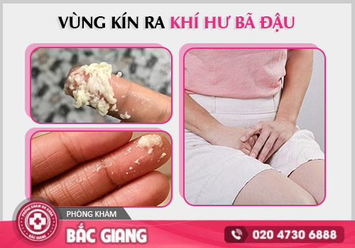 huyết trắng bã đậu