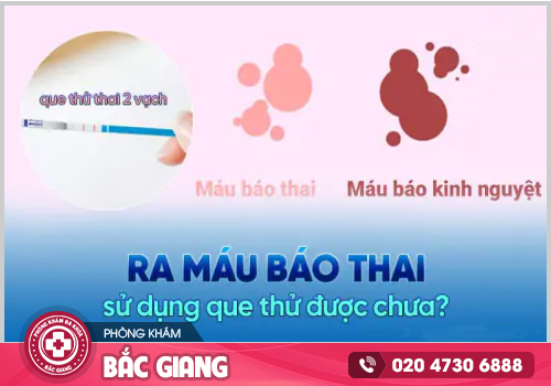 Ra máu báo thai thử que được chưa?