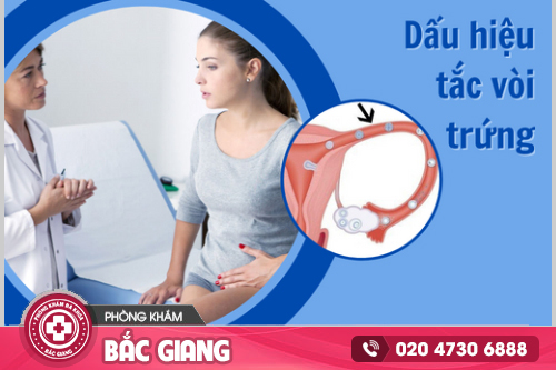Tắc ống dẫn trứng - Nguyên nhân, dấu hiệu và cách trị