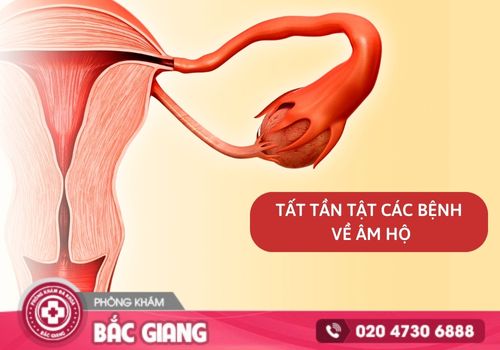 Tất tần tật các bệnh về âm hộ – Nguyên nhân, dấu hiệu và cách điều trị