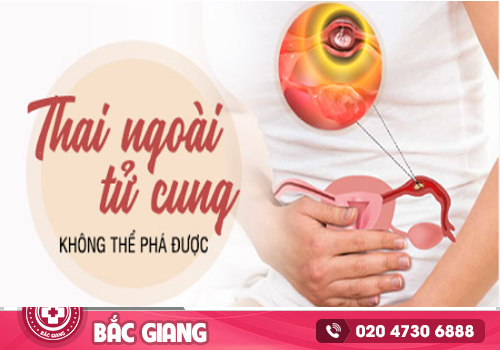 Thai chưa vào tử cung có phá được không?