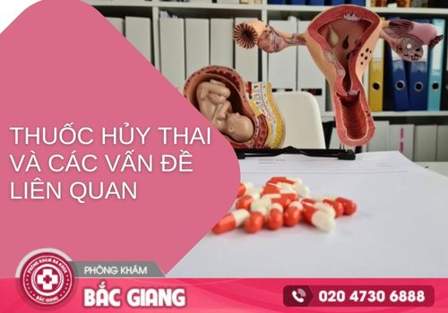 Thuốc hủy thai và những điều cần lưu ý