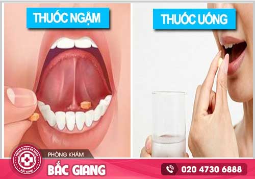 Thuốc ngậm phá thai sử dụng như thế nào cho đúng?