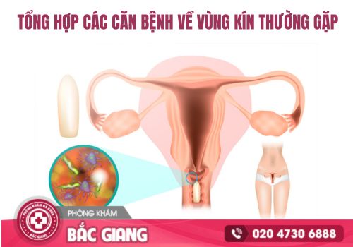 Tổng hợp các bệnh về vùng kín thường gặp ở nữ