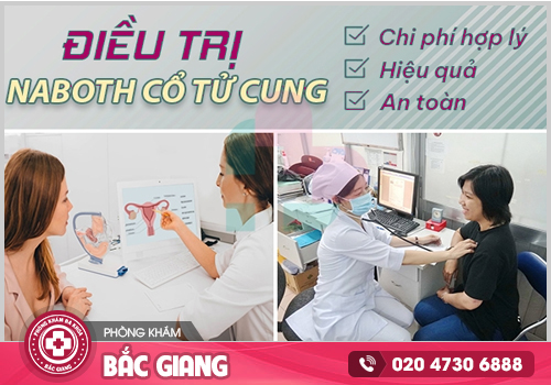 Giải đáp từ chuyên gia về cách trị nang Naboth tại nhà