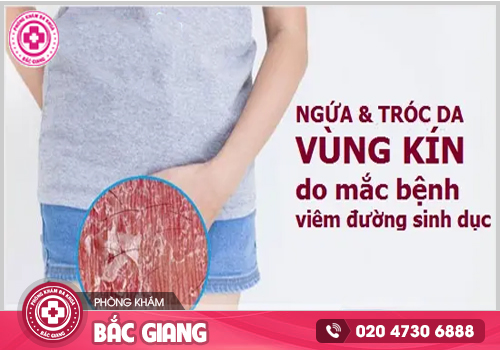 Tróc da vùng kín nữ - Nguy hiểm tiềm ẩn