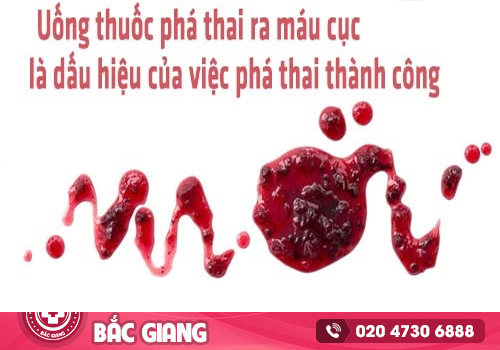 Uống thuốc phá thai bao lâu thì ra túi thai?