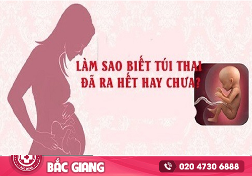 Uống thuốc phá thai bao lâu thì ra túi thai?