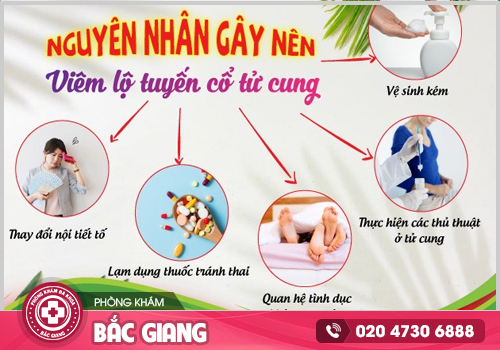 Nguyên nhân - Dấu hiệu viêm lộ tuyến cổ tử cung là gì?
