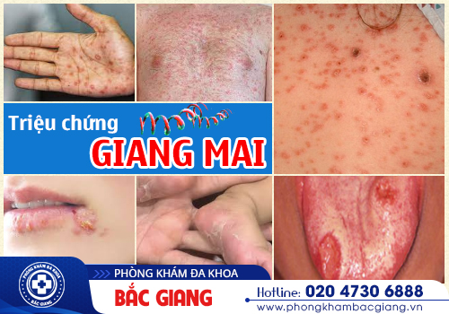 Các bệnh tình dục thường gặp