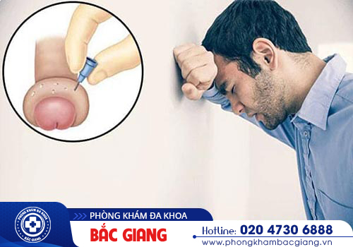Bao quy đầu bị sưng do đâu? Cách chữa trị