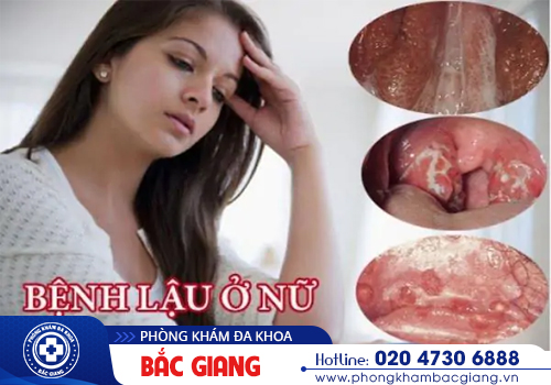 Bệnh lậu giai đoạn đầu nhận biết như thế nào?