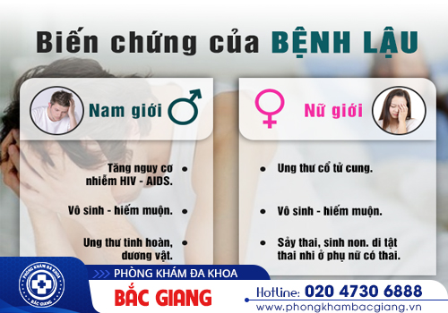 Bệnh lậu ở nữ giới - Chớ nhầm lẫn với bệnh phụ khoa thông thường