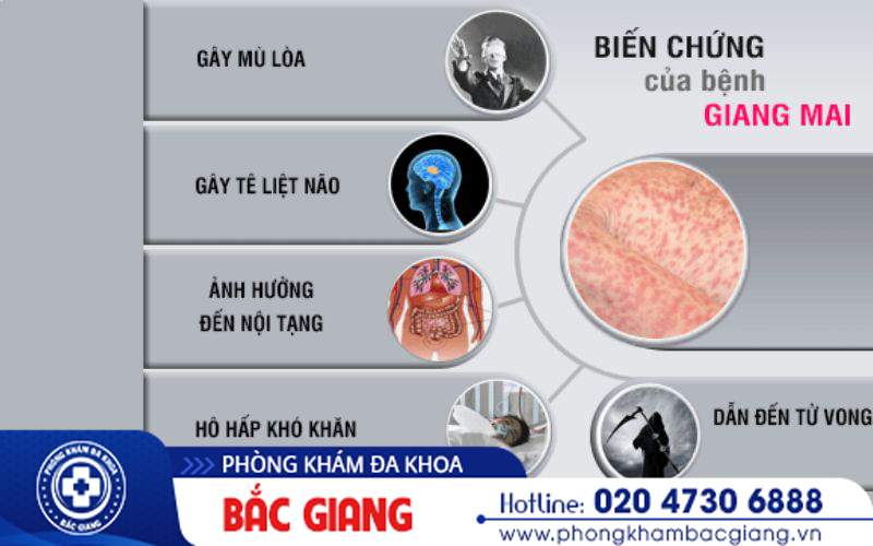 xét nghiệm giang mai ở đâu uy tín