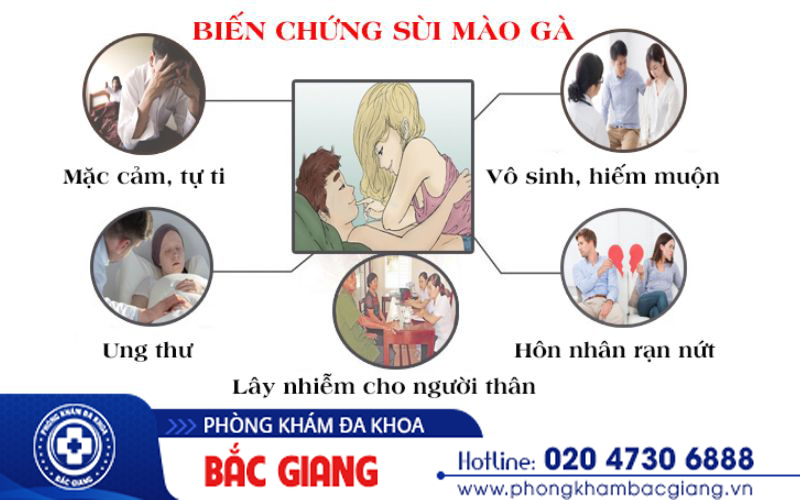 Sùi mào gà giai đoạn đầu có ngứa không?