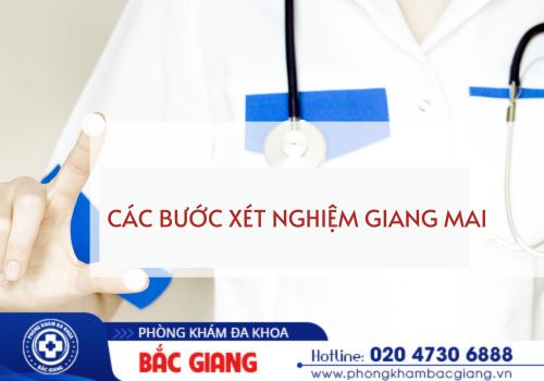 các bước xét nghiệm giang mai