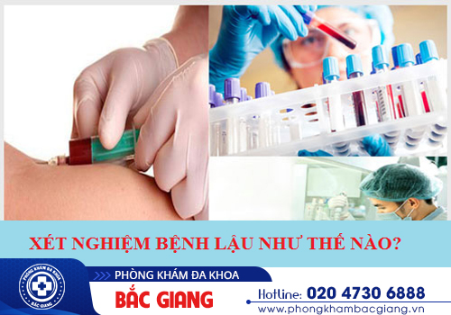 Quy trình các bước xét nghiệm lậu theo chuẩn y tế