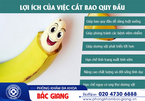 Cắt bao quy đầu và những điều cần biết