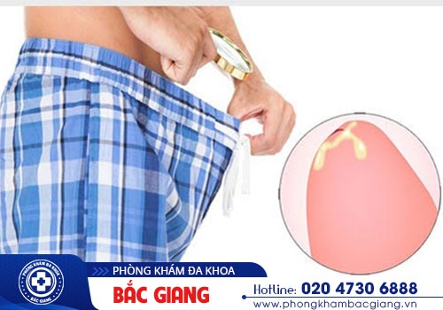 Chảy mủ ở lỗ sáo là bệnh gì? Cách điều trị?