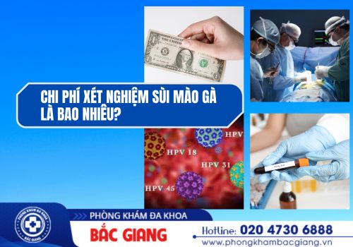 chi phí xét nghiệm sùi mào gà là bao nhiêu