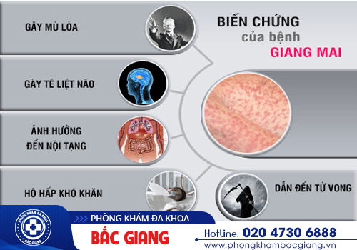 Phương pháp điều trị giang mai
